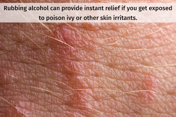 rubbing alcohol can provide relief from poison ivy irritation