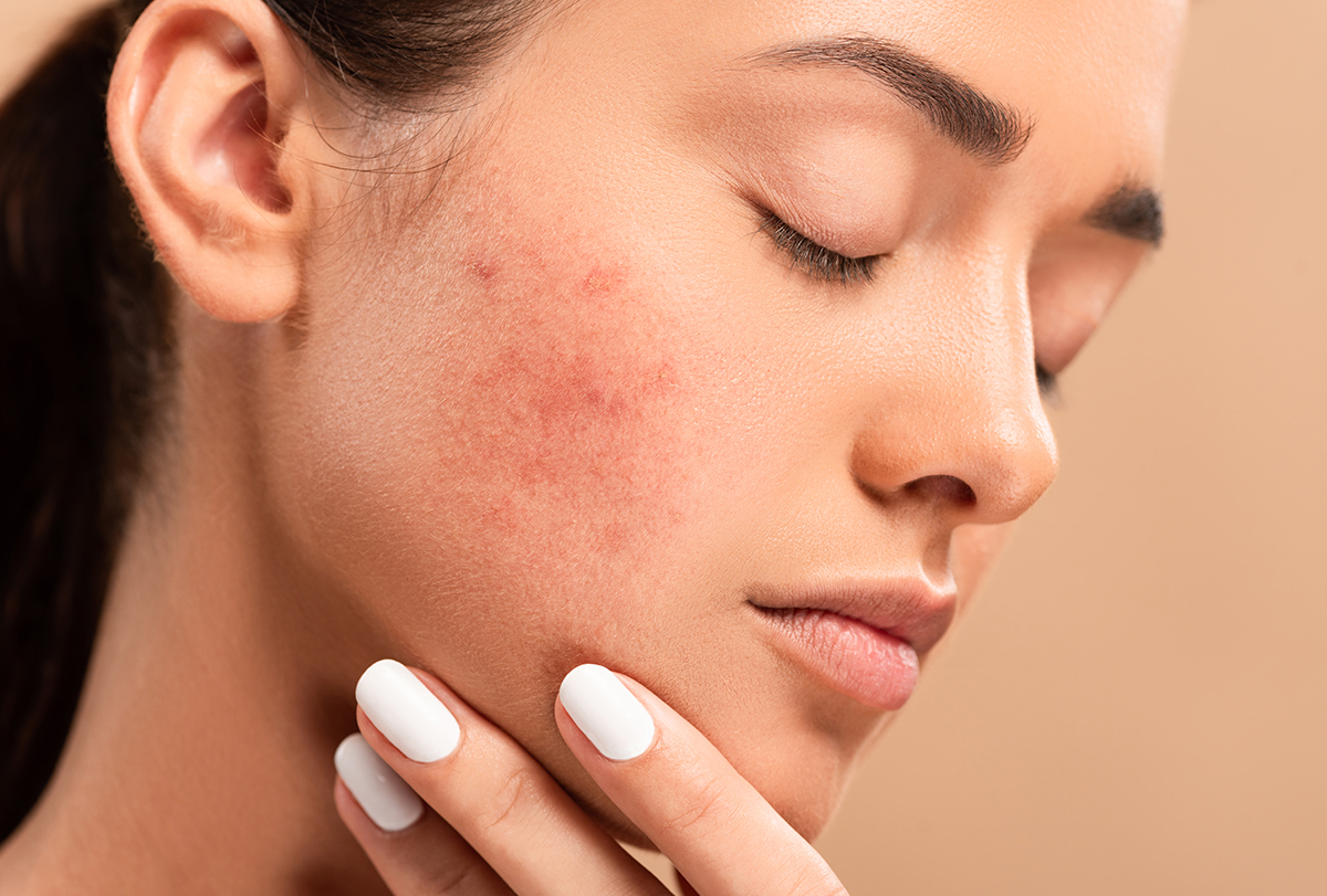 how to manage scabs on face
