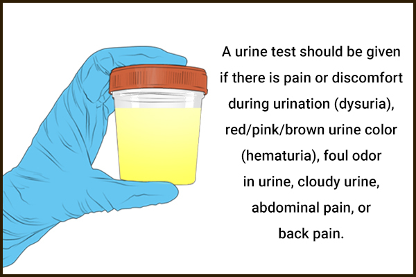 brown urine