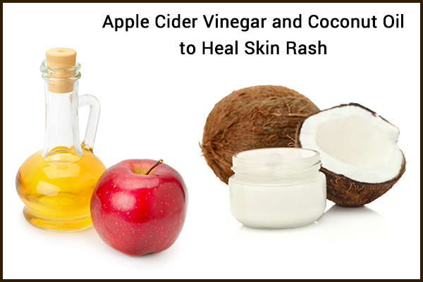 use apple cider vinegar and coconut oil to heal skin rashes