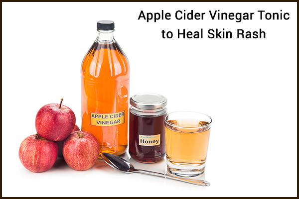prepare and use apple cider vinegar tonic for healing skin rashes