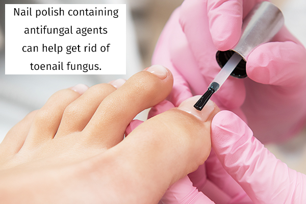 using colorless nail polish can reduce the incidence of toenail fungus