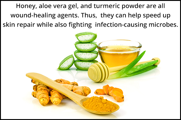 honey, aloe vera gel, turmeric powder can be used to manage hangnails