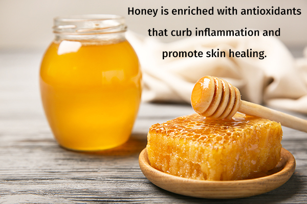 honey can help promote skin healing and can reduce impetigo
