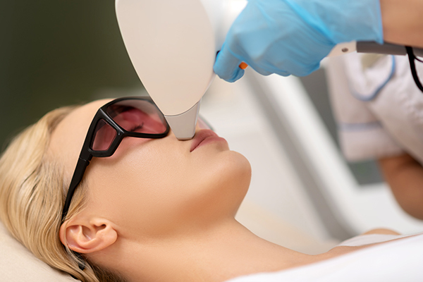 laser therapy can help fade hyperpigmentation around mouth