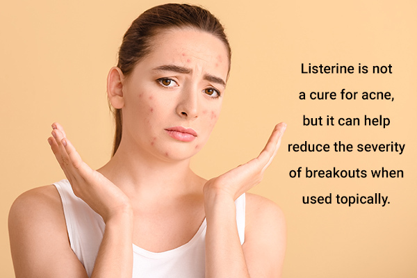 listerine usage can help reduce acne breakouts