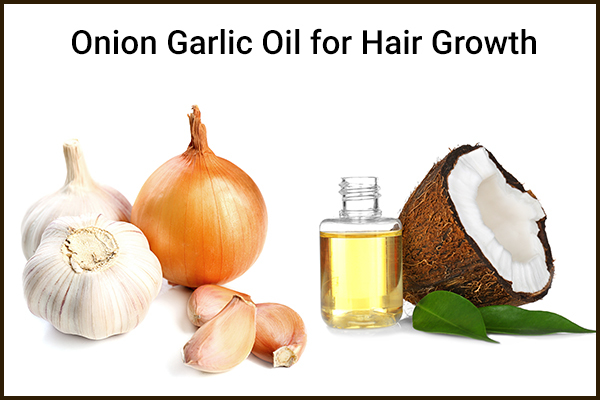 Incredible Benefits of Garlic for Hair How to Use Garlic for Hair Treatment