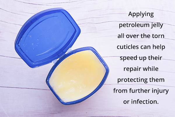 applying petroleum jelly can help repair skin damage from hangnails