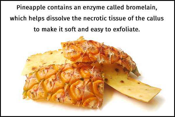pineapple peel usage can help exfoliate the calluses