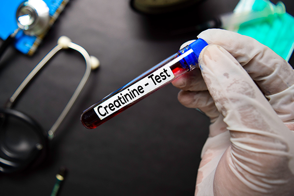 when to consult a doctor regarding high creatinine levels?