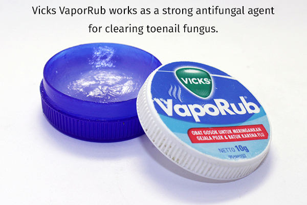 Vicks VapoRub can help manage toenail fungus