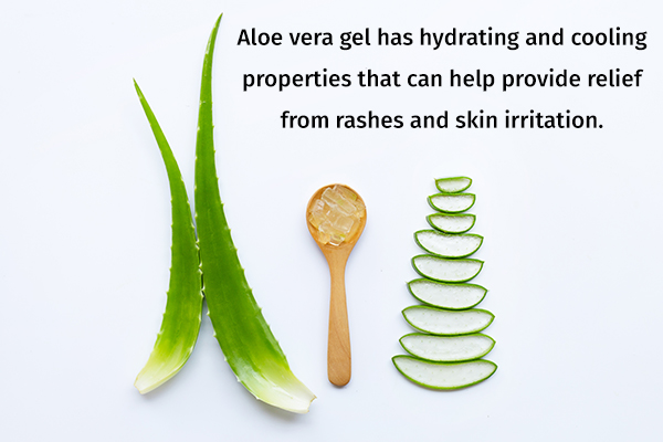 aloe vera gel can help reduce hives