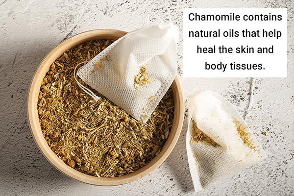 using chamomile tea bags can help soothe minor wounds