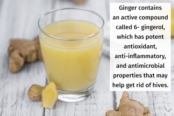 ginger may help get rid of hives