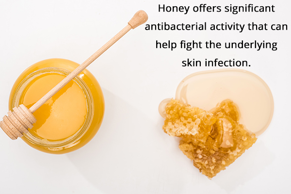 honey application can help heal carbuncles