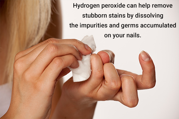 hydrogen peroxide can help remove stubborn nail stains