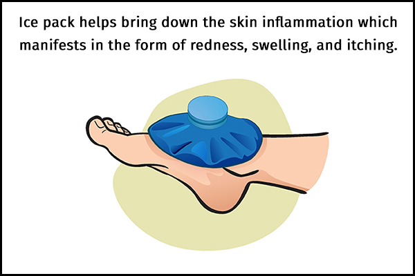 applying an ice pack can help soothe jellyfish sting