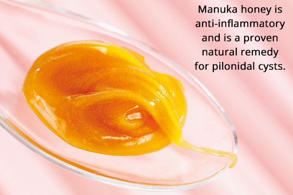 manuka honey is a proven natural remedy for pilonidal cysts