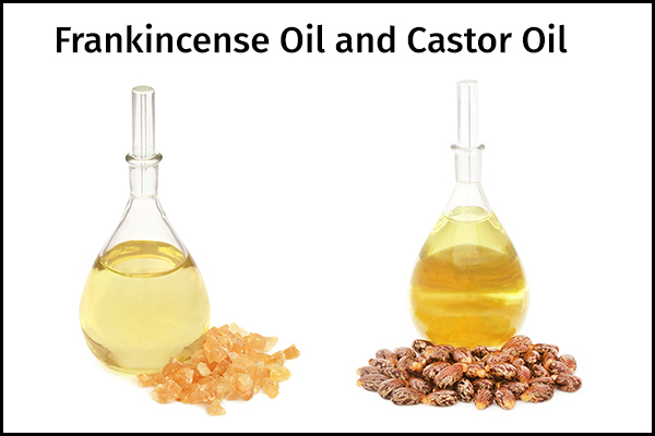 a mix of frankincense oil and castor oil can help manage lipoma