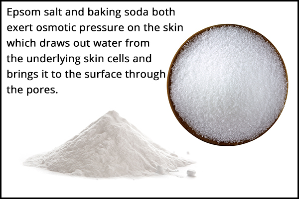 Epsom salt/baking soda can be used to remove splinters