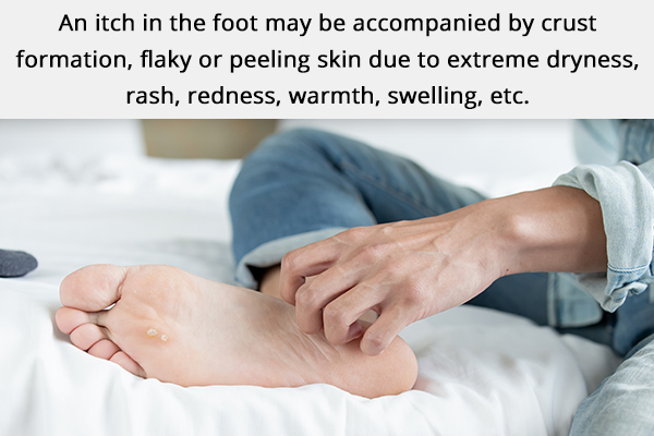 symptoms accompanying a foot itch