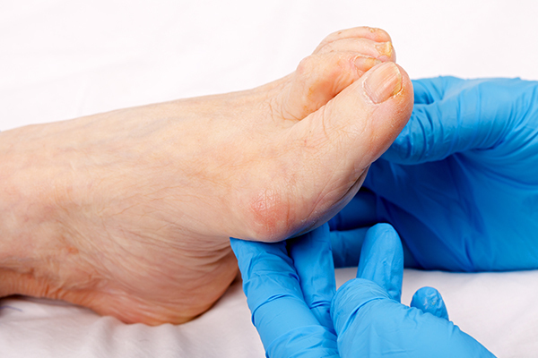 when to consult a doctor regarding itchy feet?