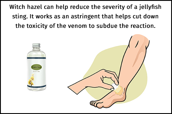 witch hazel usage can also help recover from jellyfish sting