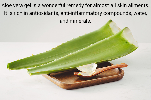 aloe vera gel application can help soothe poison ivy rashes