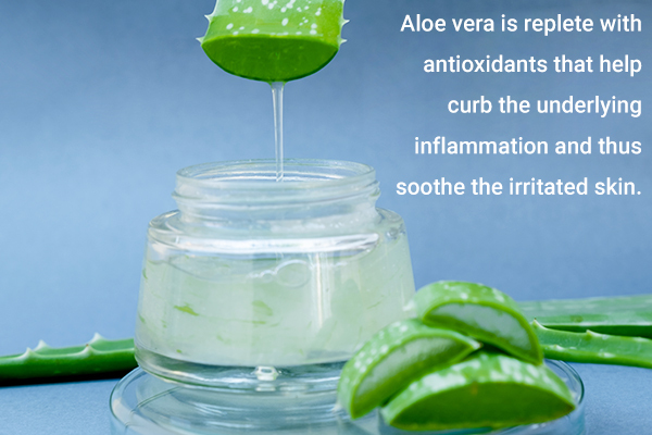 aloe vera gel application can help soothe spider bites