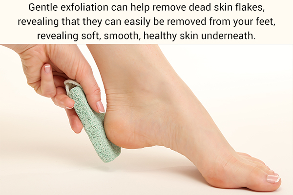 exfoliate your feet to get rid of peeling skin on feet