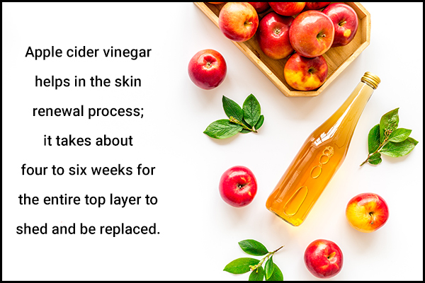 how long does it take for acv to show effects on acne?