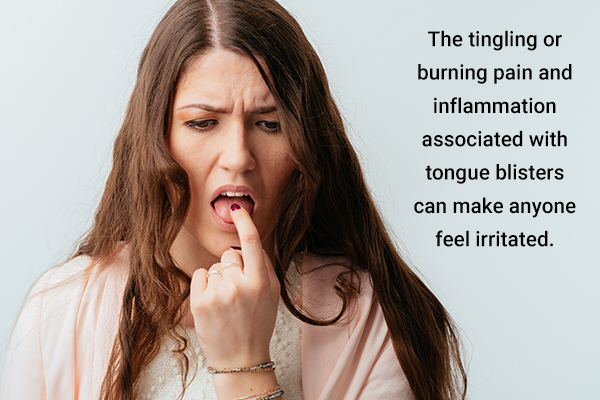 signs and symptoms of tongue blisters