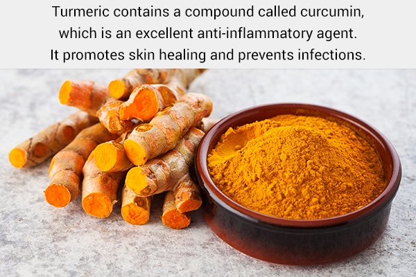 turmeric usage can be beneficial for soothing poison ivy rashes