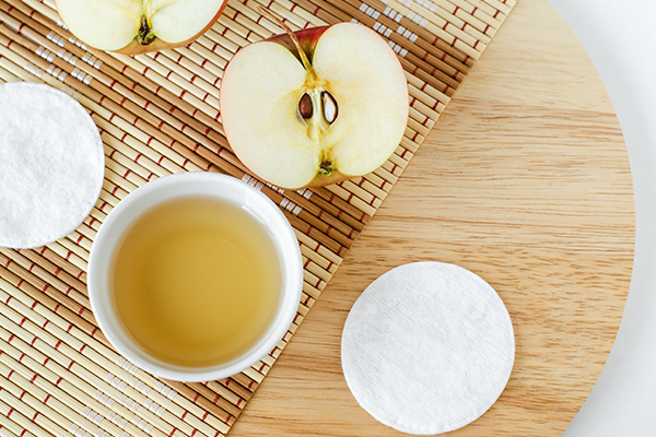 apple cider vinegar can be used as a toner for acne management