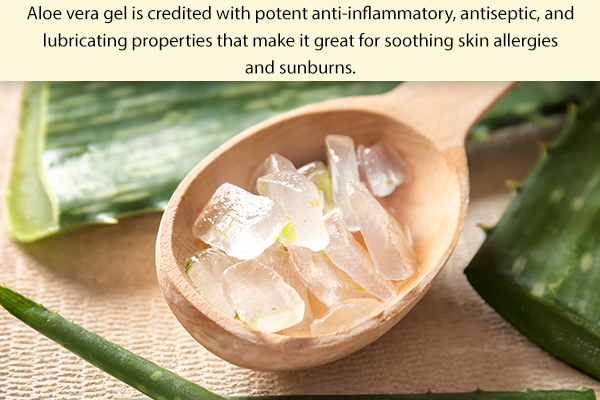 try using aloe vera gel in your natural first-aid kit