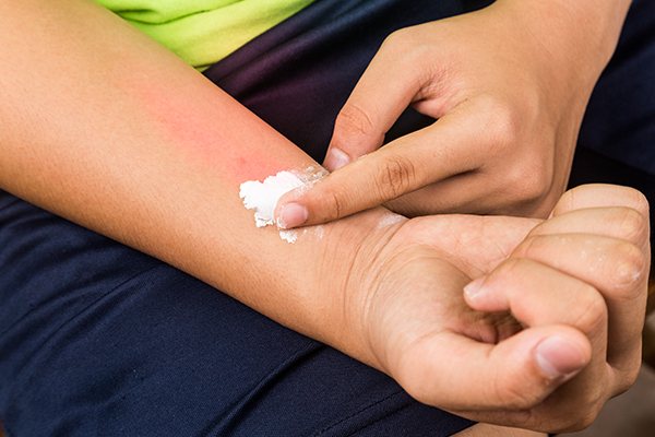 baking soda usage can help relieve irritated, itchy, and scaly skin