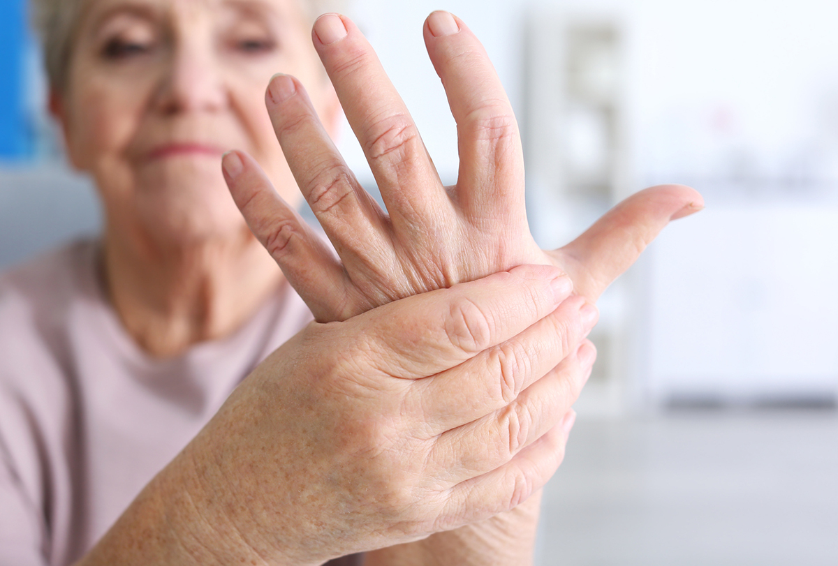 herbs and spices to manage arthritis