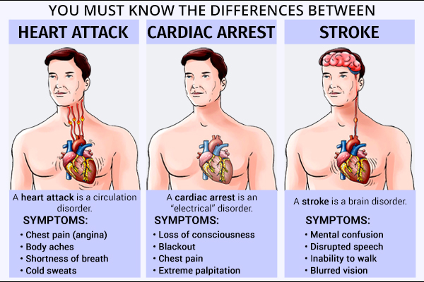 understand the symptomatic differences b/w heart attack, stroke