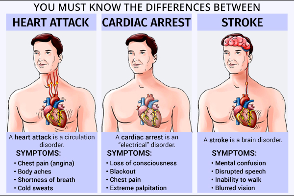 Understanding Heart Attack Cardiac Arrest And Stroke