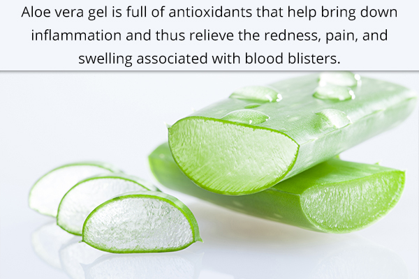 using aloe vera gel can help soothe blood blisters