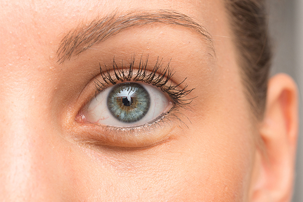 when to consult a doctor regarding puffy eyes?