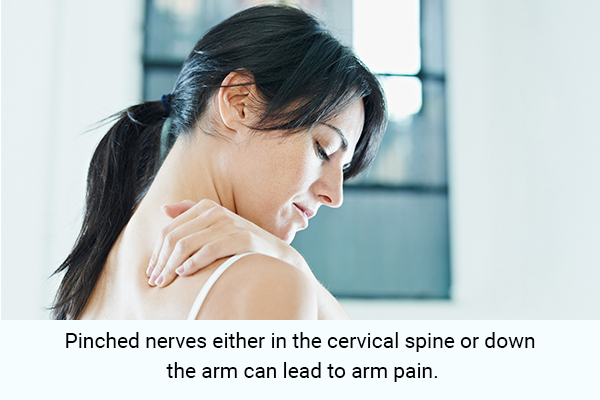 queries related to arm pain answered by experts