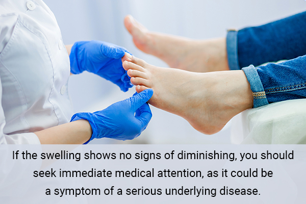 when to consult a doctor regarding swelling in the ankles and feet?