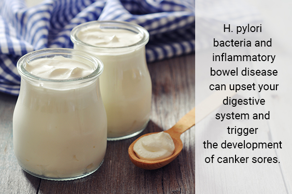 consuming yogurt can help prevent canker sores