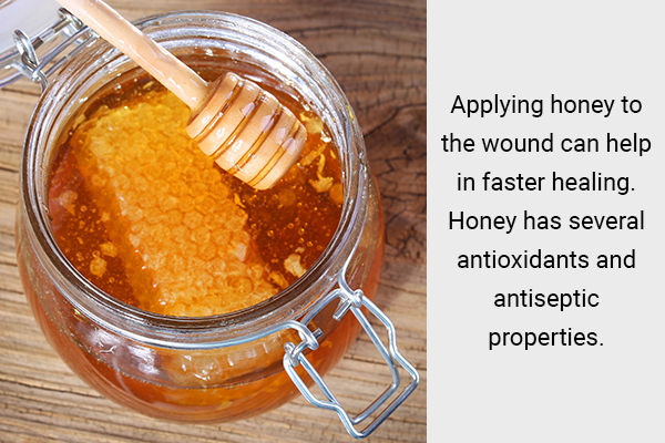 applying honey to the wound can help promote recovery
