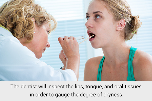 diagnosing dry mouth (xerostomia)