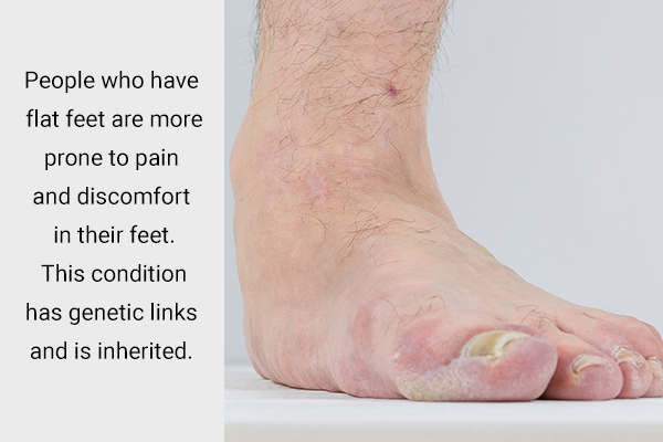 people with flat feet are more prone to foot pain and discomfort