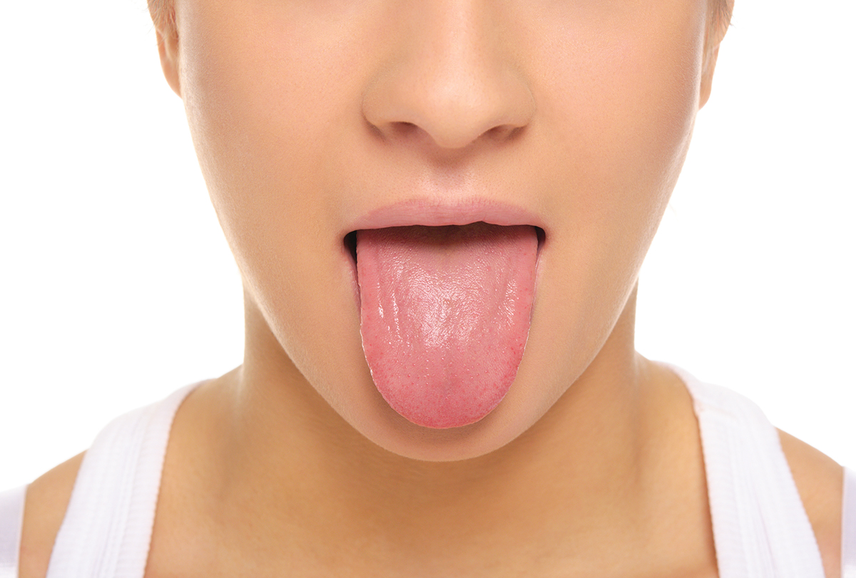 geographic tongue: causes, signs, and home remedies