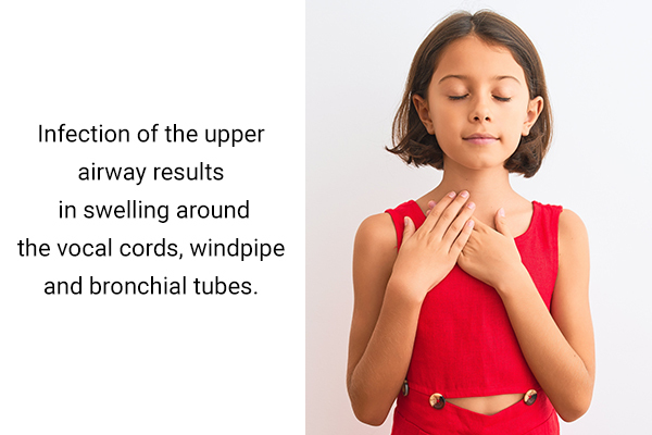 signs and symptoms of croup in children