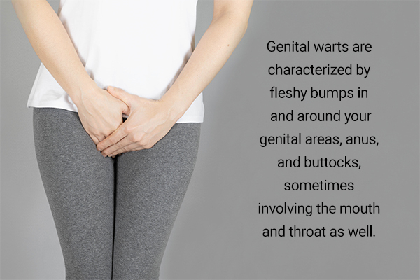 signs and symptoms linked with genital warts